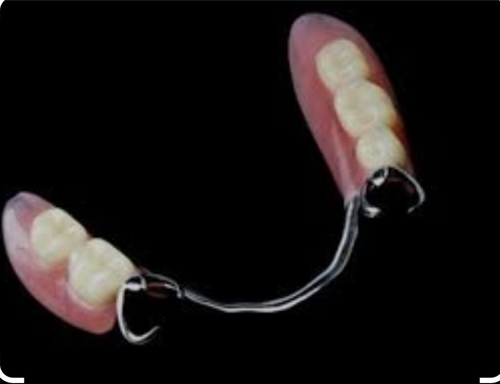 Μερικές οδοντοστοιχίες